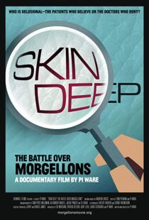 دانلود مستند Skin Deep: The Battle Over Morgellons 2019104233-36739574